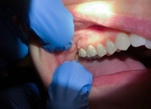 Best After-Hours Dental Trauma Care in Beulah, ND