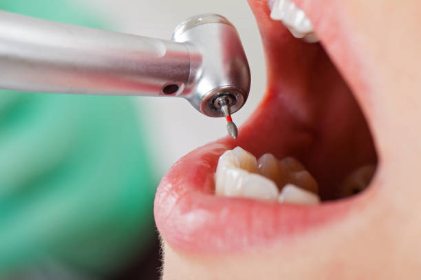 Best Same-Day Emergency Dental Services in Beulah, ND